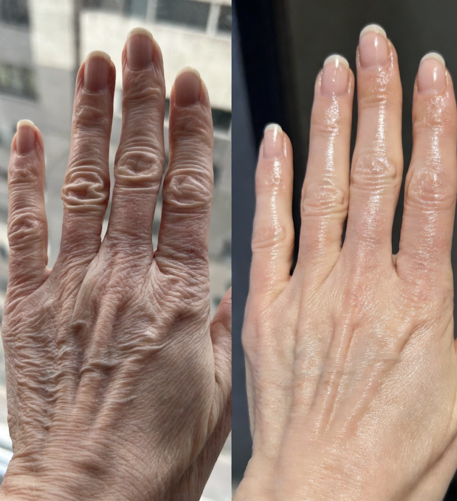 Antes e depois Regina